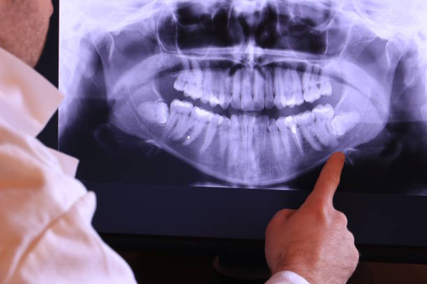 Best Emergency Tooth Extraction in Hull, IA