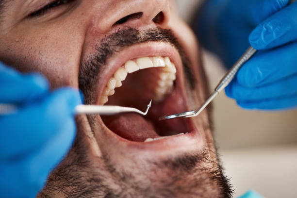 Best Emergency TMJ Treatment in Hull, IA